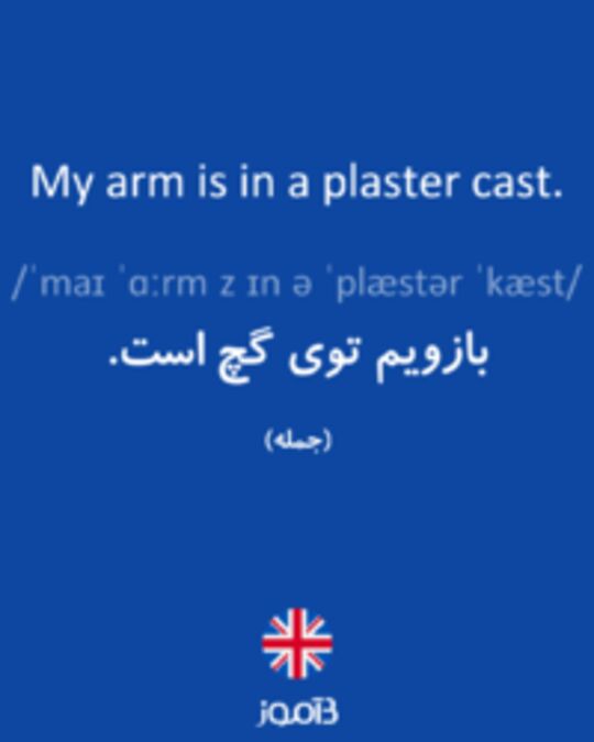  تصویر My arm is in a plaster cast. - دیکشنری انگلیسی بیاموز