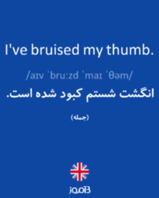  تصویر I've bruised my thumb. - دیکشنری انگلیسی بیاموز