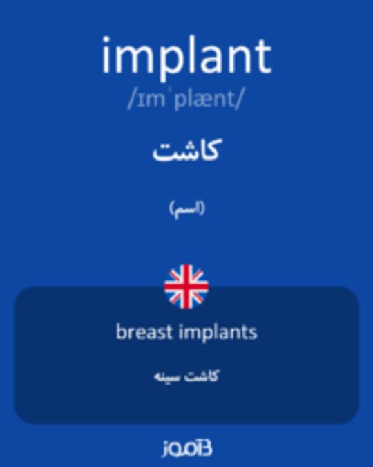  تصویر implant - دیکشنری انگلیسی بیاموز