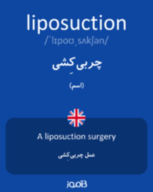  تصویر liposuction - دیکشنری انگلیسی بیاموز